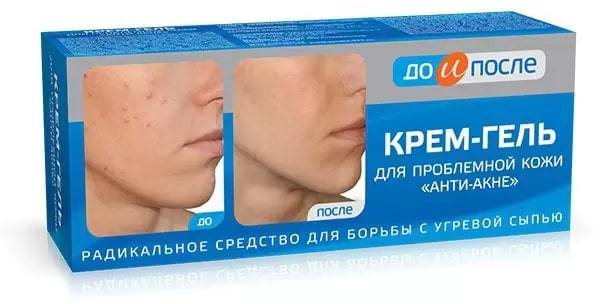 

До и После, крем-гель