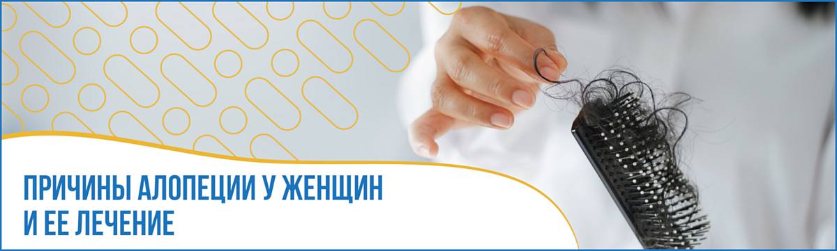 Причины алопеции у женщин и её лечение Причины алопеции у женщин и её лечение