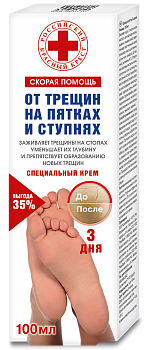 Скорая помощь, крем против трещин на пятках, 100 мл (арт. 229879)